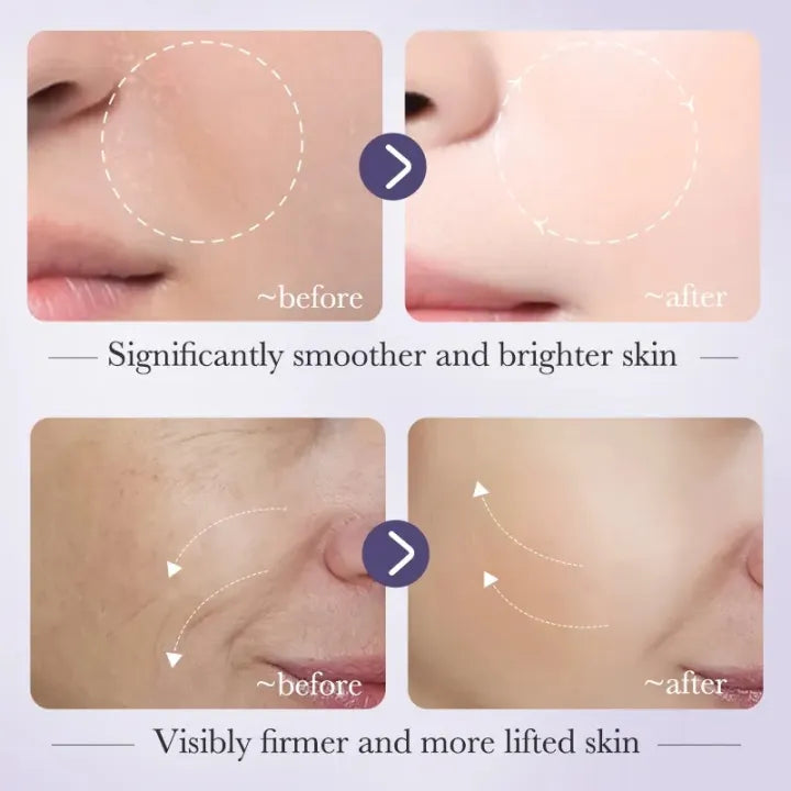 BIOAQUA Retinol Serum 30ml β Anti-Wrinkle, Dark Spot Remover, Skin Whitening Facial Essence for Women & Girls
